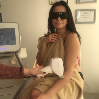 Лазерная эпиляция, на диодном лазере LUMENIS LightSheer DESIRE
                    Майстер депіляції Виктория Харків