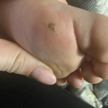 Виведення бородавок
                    Подолог Олена Львов