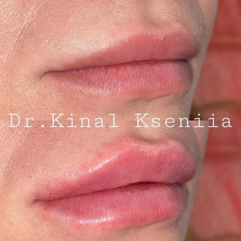 Ксенія Киналь, Глеваха Фото - 5