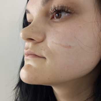 Аліна Костриба, Хмельницький Фото - 1