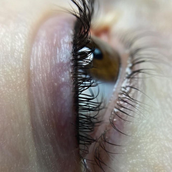 Межресничка
                    Бровіст Диана Маріуполь