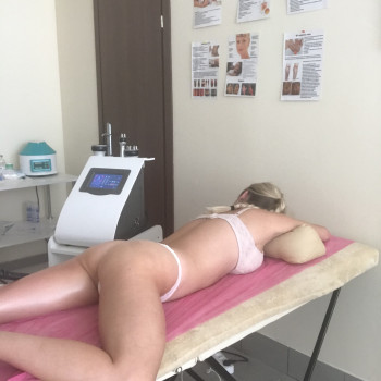 Антицеллюлитный массаж
                    Мастер депиляции Виктория Харьков