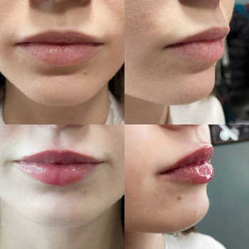 Дарья Карпенко, Голая Пристань Фото - 5