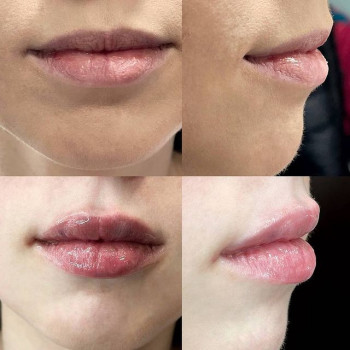 Дарья Карпенко, Голая Пристань Фото - 6