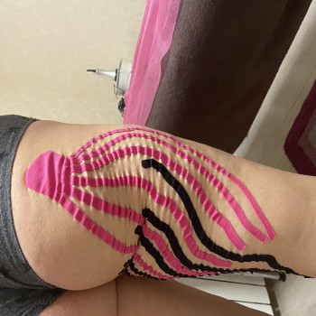 Лимфадренажное тейпирование