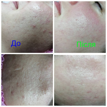 Beauty clinic Dr.Pelikh, Хмельницький Фото - 16