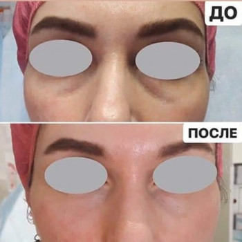 Лусине Караханян, Днепрорудное Фото - 5