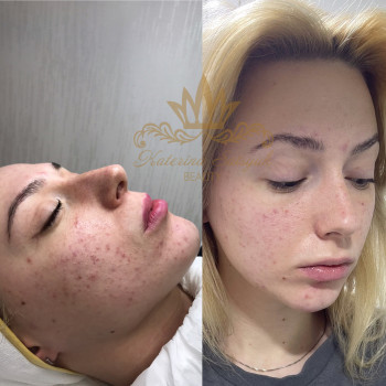 Екатерина Сацюк, Київ Фото - 5