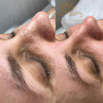 Екатерина Сацюк, Київ Фото - 6