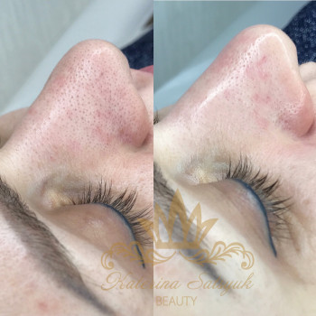 Екатерина Сацюк, Київ Фото - 10