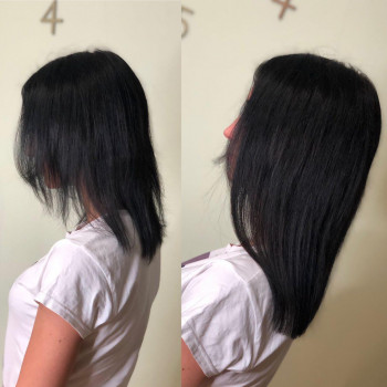 Загущение височной зоны и длины