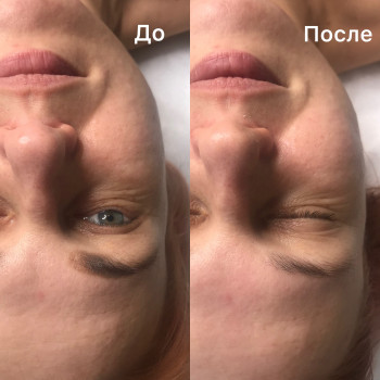 Массаж лица