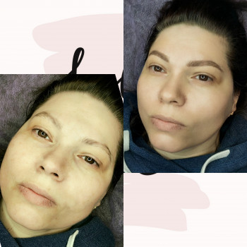 Пудровое напыление бровей, татуаж бровей, перманентный макияж
                    Мастер перманентного макияжа Татьяна Киев