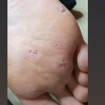 Фото из портфолио специалиста Виктория Пушко (подолог, Дунаевцы)