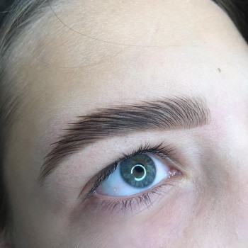 Алена Била, Жмеринка Фото - 5