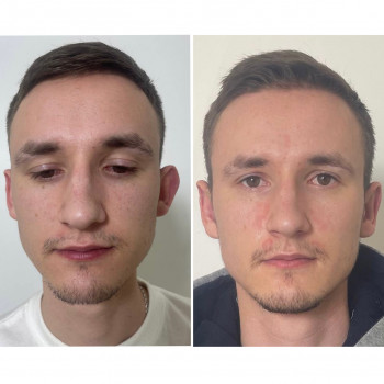 Абдель Эрритали, Харків Фото - 76