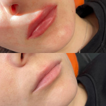 Перманентный макияж губ
                    Майстер перманентного макіяжу Елизавета Житомир