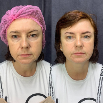 Мария Васковец, Киев Фото - 7