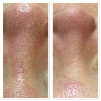 Результат Комбінованої чистки Holy Land