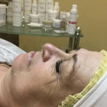 Программа Silk для моментального лифтинг эффекта
                    Косметолог Инна Мариуполь