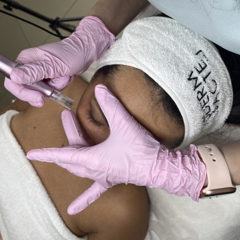 Дермапен (дермаштамп, фракционная мезотерапия)
                    Косметолог-эстетист Марина Сумы