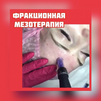 Фракционная мезотерапия
                    Косметолог Инна Мариуполь