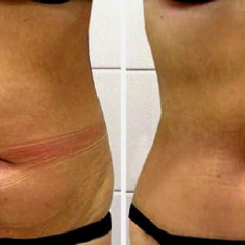 3 процедуры)