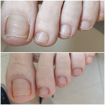 Педикюр пальцев