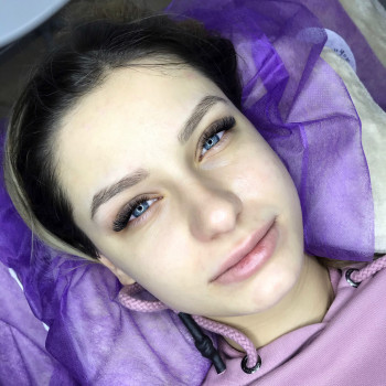 3д нарощення