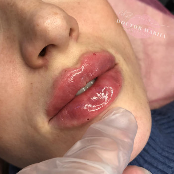 Мария Малая, Київ Фото - 6