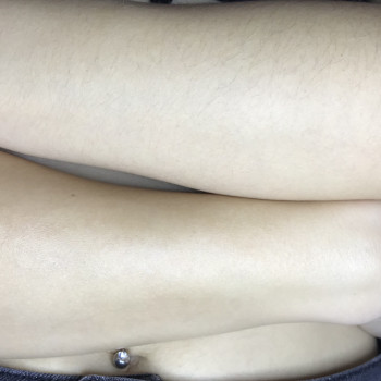 Руки До/После