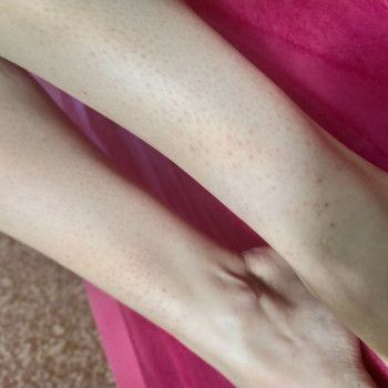 Наталія Кононова, Запоріжжя Фото - 8