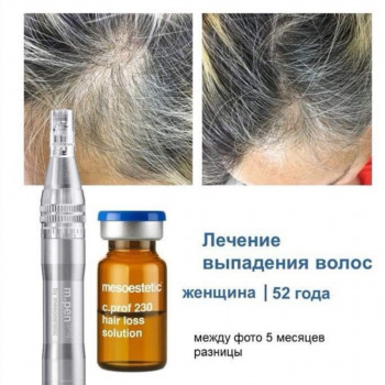 Лариса Петрівна, Луцьк Фото - 58