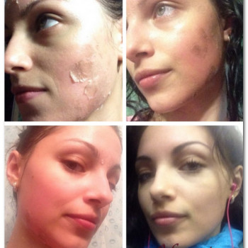 КОРАЛЛОВЫЙ ПИЛИНГ ROSE DE MЕR
                    Косметолог Инна Мариуполь