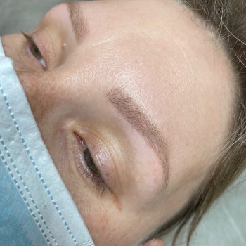 Зажившая работа через 1,5 месяца