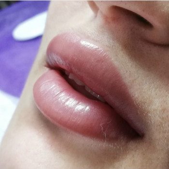 Анна Хиблина, Мелитополь Фото - 6