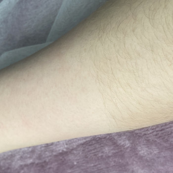 В процессе шугаринга рук. Одна из самых популярных процедур 