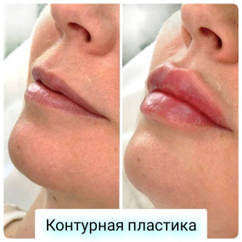 GENETIX, Одесса Фото - 63