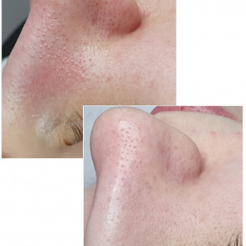 Анастасия Захарчук, Днепр Фото - 17