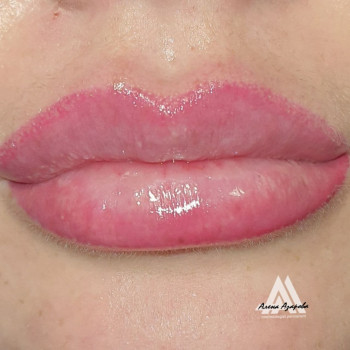 Увеличение губ в технике "Бант" и перманентный макияж в техн