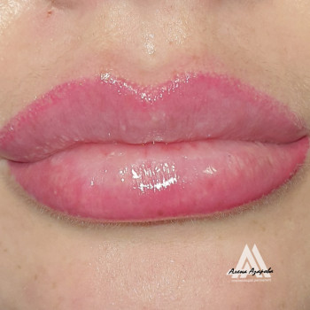 Увеличение губ и перманентный макияж "Амбре"
