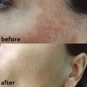 Владислава Галкiна, Київ Фото - 6