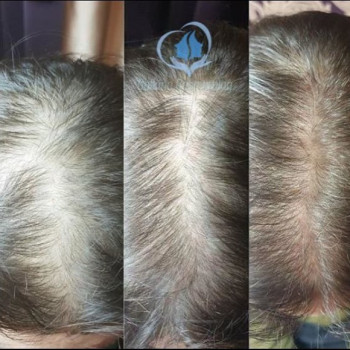 Владислава Галкiна, Київ Фото - 5