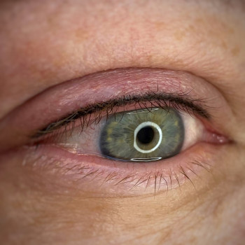 Межреснична стрелка