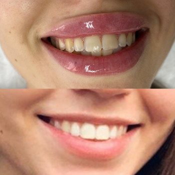 Center of Perfect Beauty, Винница Фото - 6