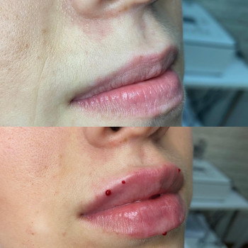 Center of Perfect Beauty, Винница Фото - 7