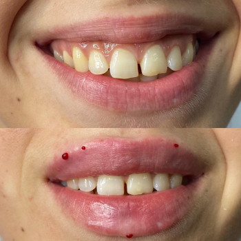 Center of Perfect Beauty, Винница Фото - 8