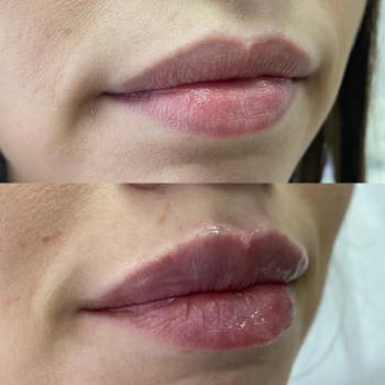 Center of Perfect Beauty, Винница Фото - 9