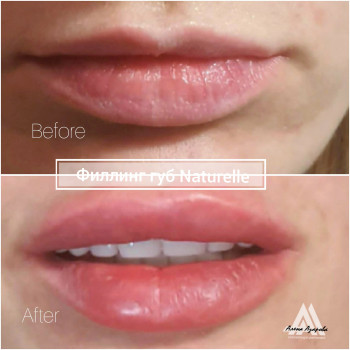 Олена Азарова, Харків Фото - 54