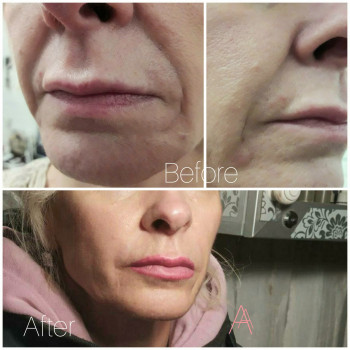 Олена Азарова, Харків Фото - 72